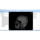 MicroDicom 
