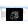 MicroDicom 